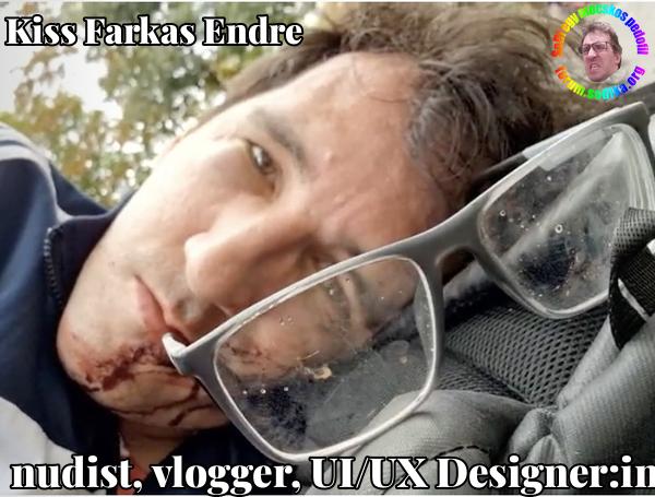 Farkas Kiss Endre UI/UX Designer:in bei  NOSUN shaping brands  nudist vlogger