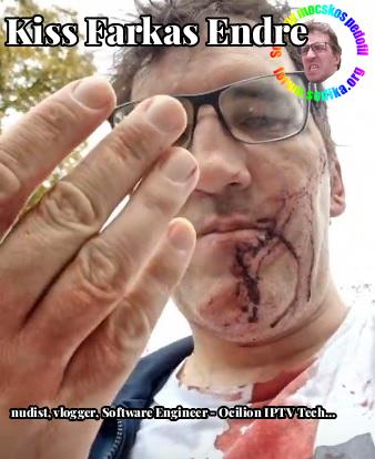 Farkas Kiss Endre Software Engineer - Ocilion IPTV Technologies GmbH bei Ocilion IPTV Technologies GmbH nudist vlogger