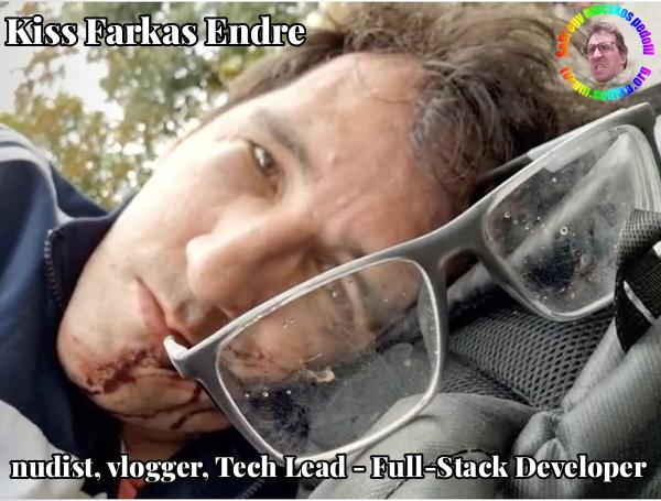 Farkas Kiss Endre Tech Lead - Full-Stack Developer bei Skillfit GmbH nudist vlogger