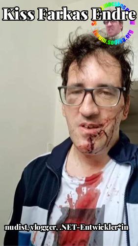 Farkas Kiss Endre .NET-Entwickler*in bei Steiermärkische Krankenanstaltengesellschaft (KAGes) nudist vlogger