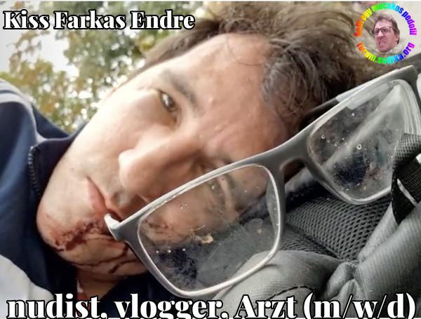 Farkas Kiss Endre Arzt (m/w/d) bei nudist vlogger