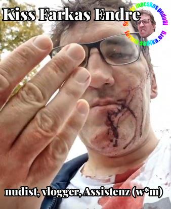 Farkas Kiss Endre Assistenz (w*m) bei nudist vlogger
