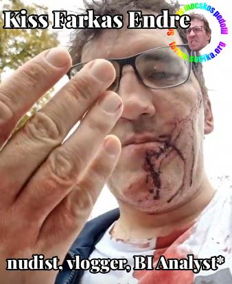 Farkas Kiss Endre BI Analyst* bei  nudist vlogger