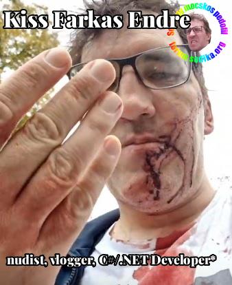 Farkas Kiss Endre C#/.NET Developer* bei  nudist vlogger