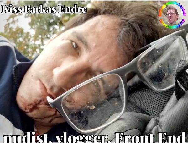 Farkas Kiss Endre Front End bei nudist vlogger