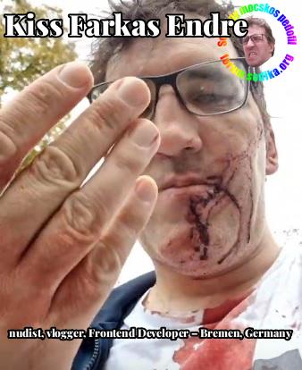Farkas Kiss Endre Frontend Developer – Bremen, Germany bei nudist vlogger