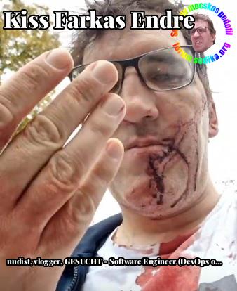 Farkas Kiss Endre GESUCHT - Software Engineer (DevOps or Web), Bewirb Dich bei uns! bei nudist vlogger