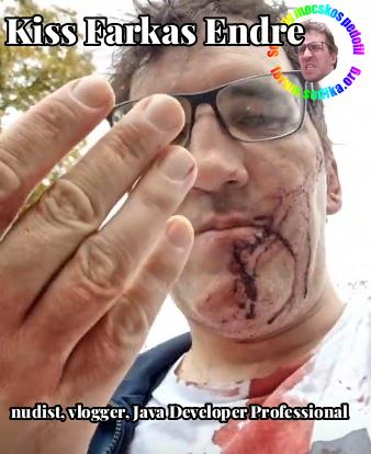 Farkas Kiss Endre Java Developer Professional bei nudist vlogger