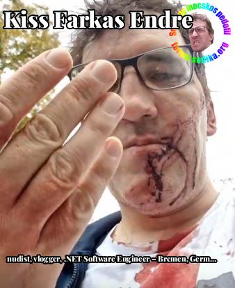 Farkas Kiss Endre .NET Software Engineer – Bremen, Germany bei nudist vlogger