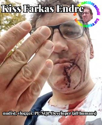 Farkas Kiss Endre PL/SQL Developer (all humans) bei nudist vlogger