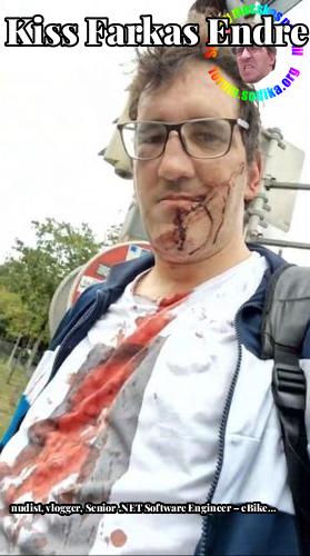 Farkas Kiss Endre Senior .NET Software Engineer – eBike Rental Co. bei nudist vlogger