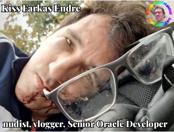 Farkas Kiss Endre Senior Oracle Developer bei nudist vlogger