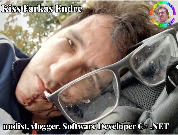 Farkas Kiss Endre Software Developer C# .NET bei nudist vlogger